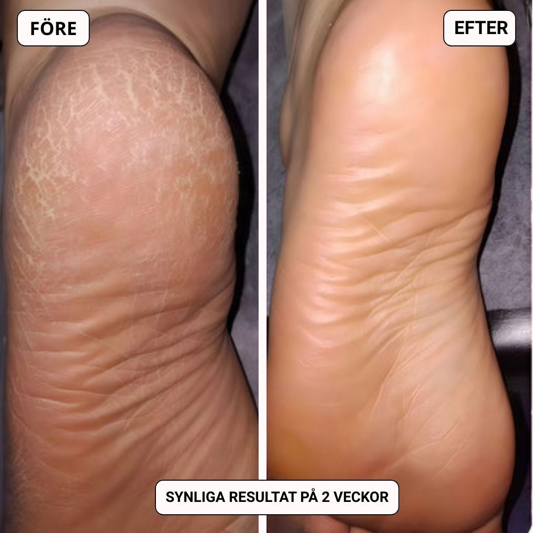 Kizo GlowPro - Din lyxiga fotvårdsritual